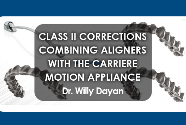 Class II Corrections By Combining Aligners with the Carriere Motion Appliance
