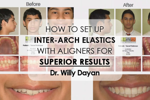 How to Set Up Inter-Arch Elastics with Aligners for Superior Results