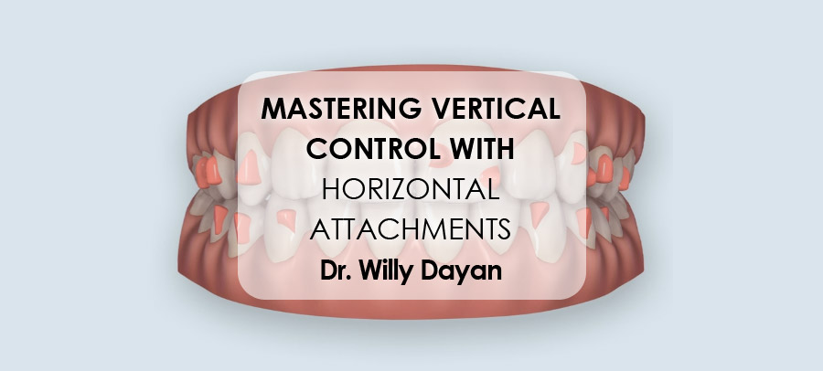 Mastering Vertical Control With Horizontal Attachments