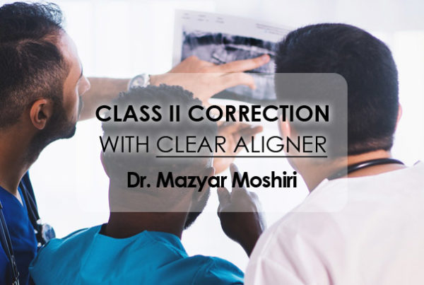 Webinar Class II Correction with Clear Aligner